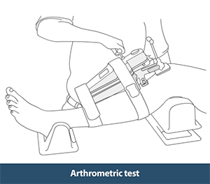 Arthrometric