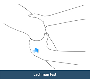Lachman Test