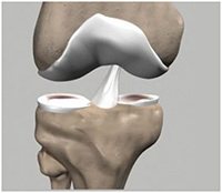 Ligament Injuries