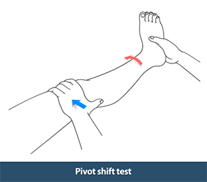 pivot-shift