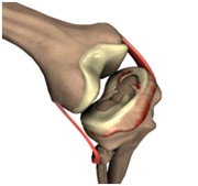 Sports Injuries