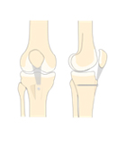 Sports Injuries